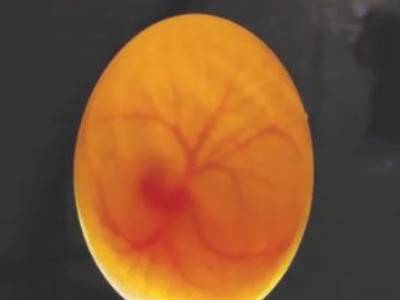 死胎蛋照蛋图图片